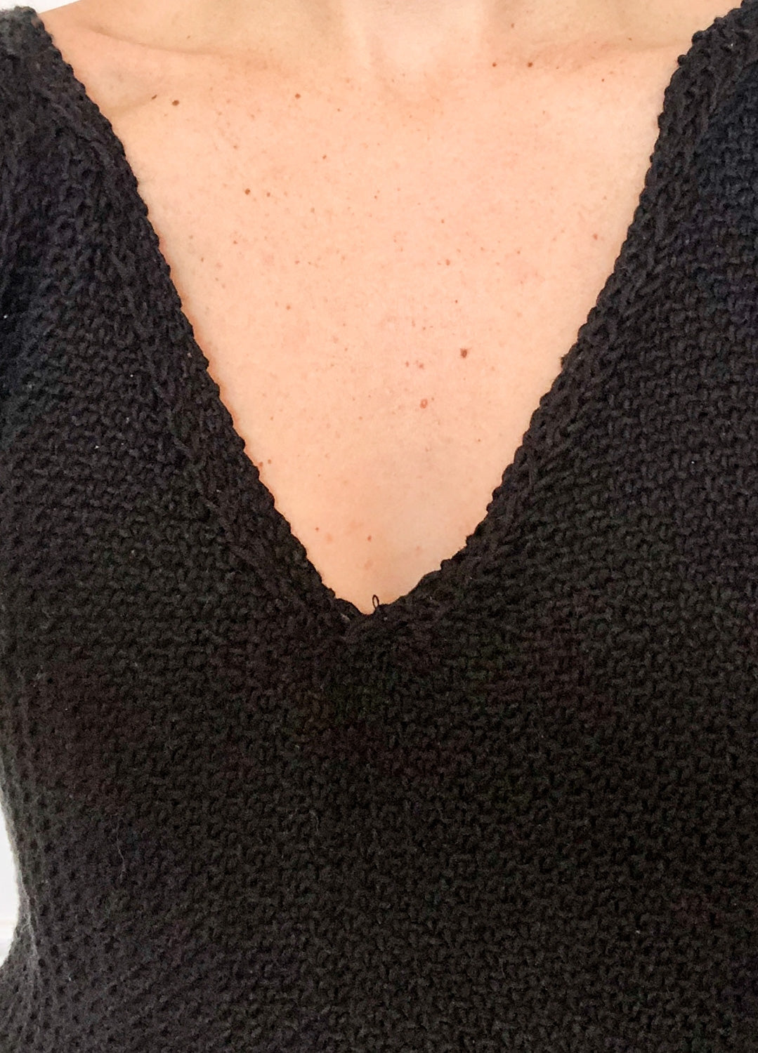 Hibiscus Top Kit